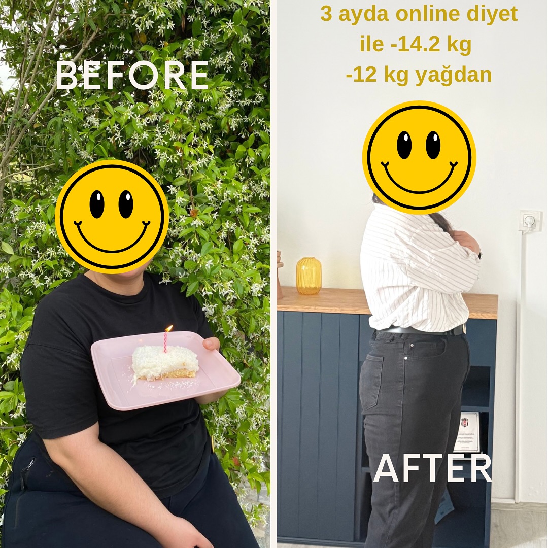 Online diyet ile 3 ayda 14,2 kilo veren danışanın önce ve sonra fotoğrafı